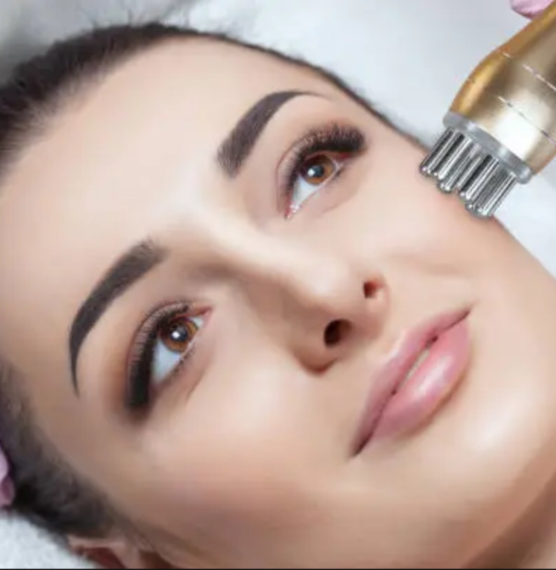 Close-up of a woman receiving a radio frequency facial treatment on her cheek.