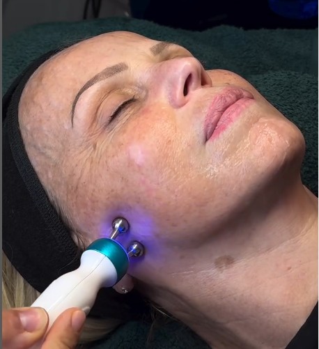 Woman receiving a facial treatment with a blue light therapy device on her cheek.